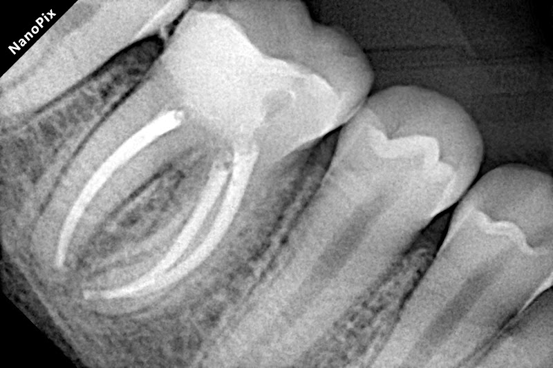 Foto 3 de Dra Mychelle Zarbin - Dentista Urgência e Emergência l 24h Sinop MT