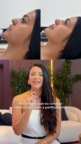 Foto 2 de Dra Mylena Berner Harmonização Facial - Alphaville