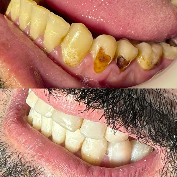 Foto 3 de Dra Mylena Karen - Facetas e odontologia estética em Feira de Santana