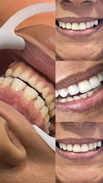 Foto 2 de Dra. Naara Pereira | Cirurgiã Dentista