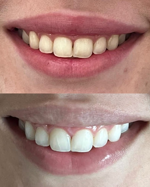 Foto 3 de Dra. Naara Pereira | Cirurgiã Dentista