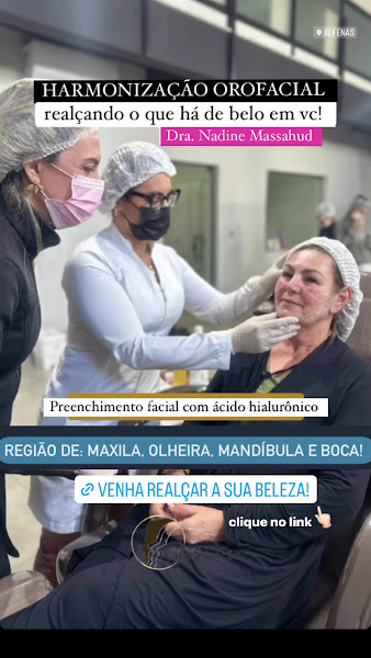 Foto 2 de Dra. Nadine Massahud HARMONIZAÇÃO OROFACIAL - Botox, Preenchimentos e bioestimuladores