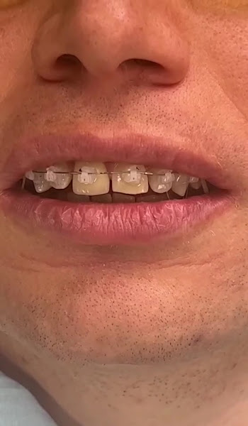 Foto 4 de Dra. Nadja Offa