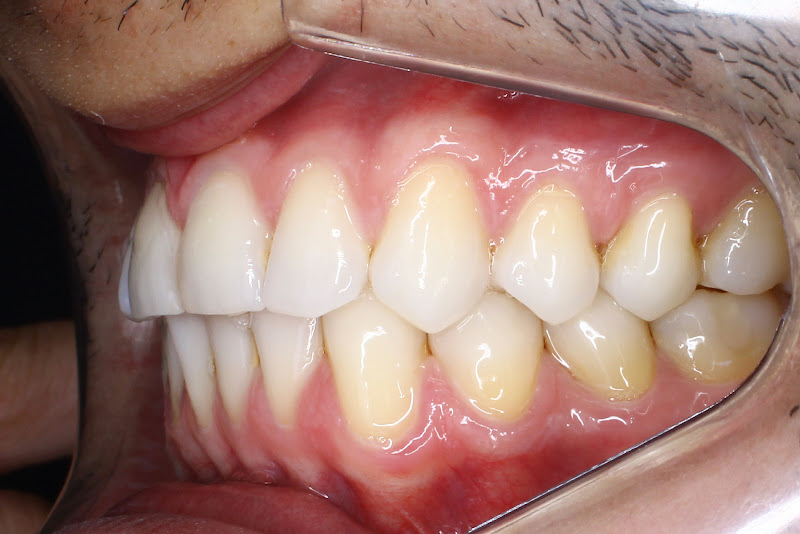 Foto 3 de Dra. Naiara Bastos - Invisalign | Barra da Tijuca