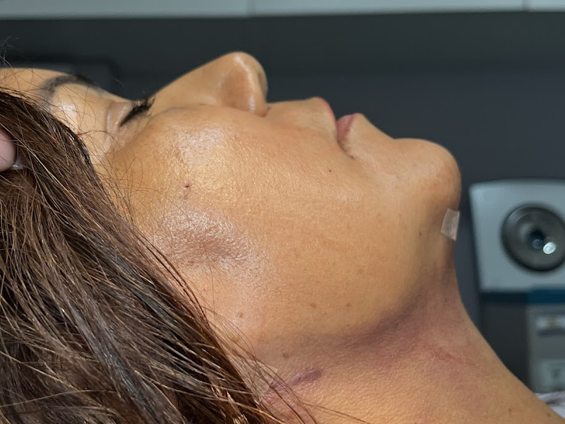Foto 2 de Dra Naila Lima | Lipo Cervico Facial