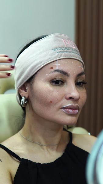 Foto 2 de Dra Natacha Guimarães | Harmonização Facial