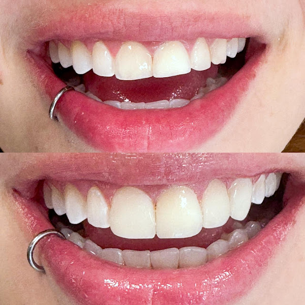 Foto 2 de Dra. Natalia de Paula Odontologia e Ciência