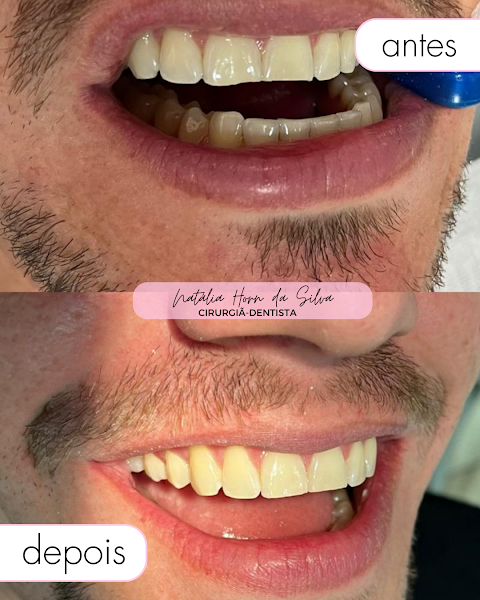 Foto 3 de Dra. Natália Horn da Silva | Cirurgiã-Dentista