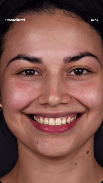 Foto 3 de Dra Natalia Liuzzi - Lentes de Contato Dental e Facetas de Porcelana - Dental Tourism - Dental Veneers - Dentist for Expats