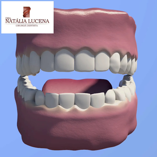 Foto 4 de Dra. Natália Lucena | Implantes dentários em Fortaleza