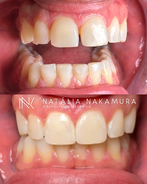 Foto 3 de Dra Natália Nakamura- Odontologia Estética