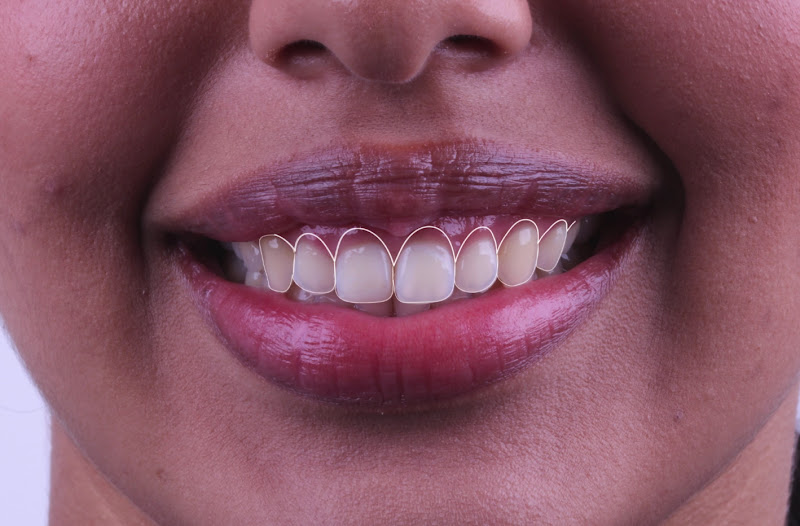 Foto 2 de Dra. Natalia Olimpio - Periodontista Especialista em Campinas