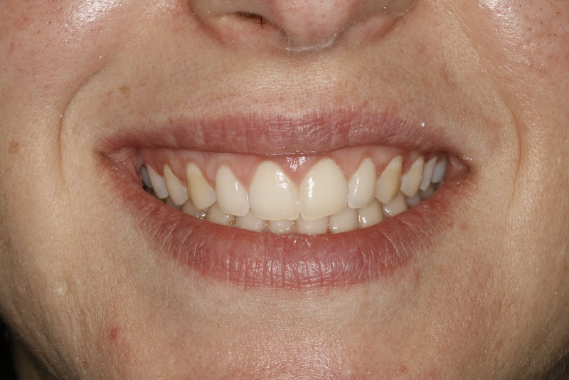 Foto 3 de Dra. Natalia Olimpio - Periodontista Especialista em Campinas