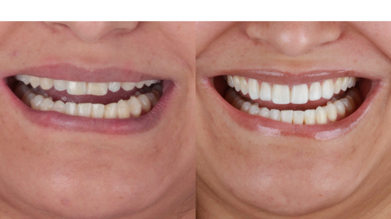 Foto 2 de Dra. Natália Rafaela - Odontologia Digital