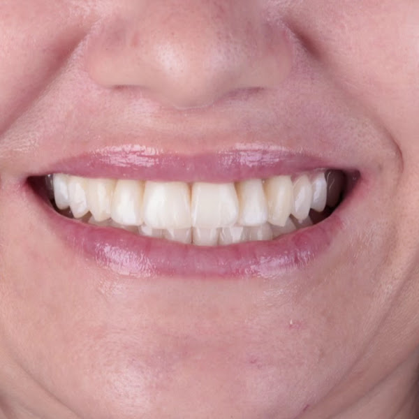 Foto 3 de Dra. Natália Rafaela - Odontologia Digital