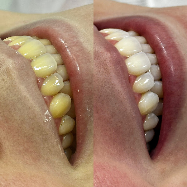 Foto 3 de Dra. Natércia Barbosa - Odontologia