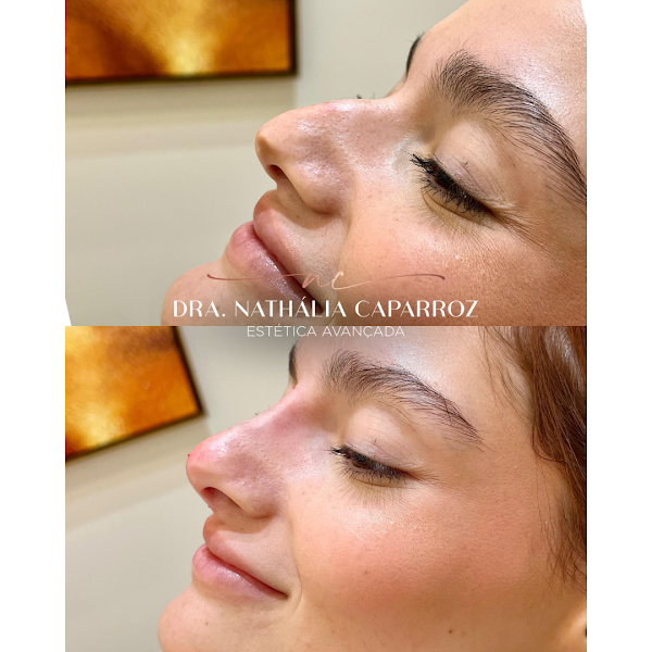 Foto 2 de Dra. Nathália Caparroz - Harmonização Facial | Harmonização Corporal em Balneário Camboriú