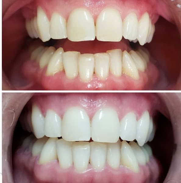 Foto 2 de Dra. Nathália Mauad Svizzero CLINICA BLEND