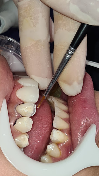 Foto 3 de Dra. Nathália Mauad Svizzero CLINICA BLEND