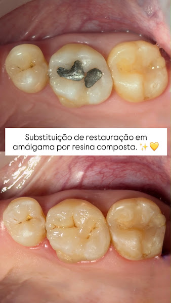 Foto 3 de Dra Nathani Araújo | Dentista especialista em Odontologia Estética e Prótese dentária