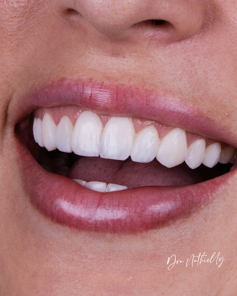 Foto 2 de Dra. Nathielly Leite Odontologia