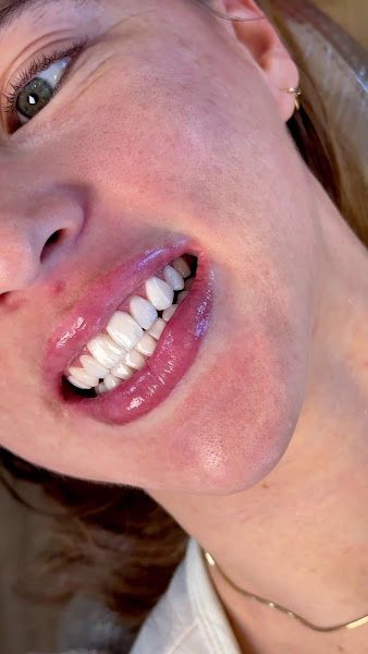 Foto 3 de Dra. Nathielly Leite Odontologia