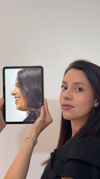 Foto 3 de Dra. Nathiely Garbosa | Harmonização Facial