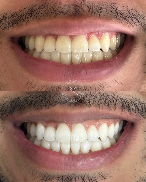 Foto 3 de Dra. Nayara Matos | Cirurgiã Dentista