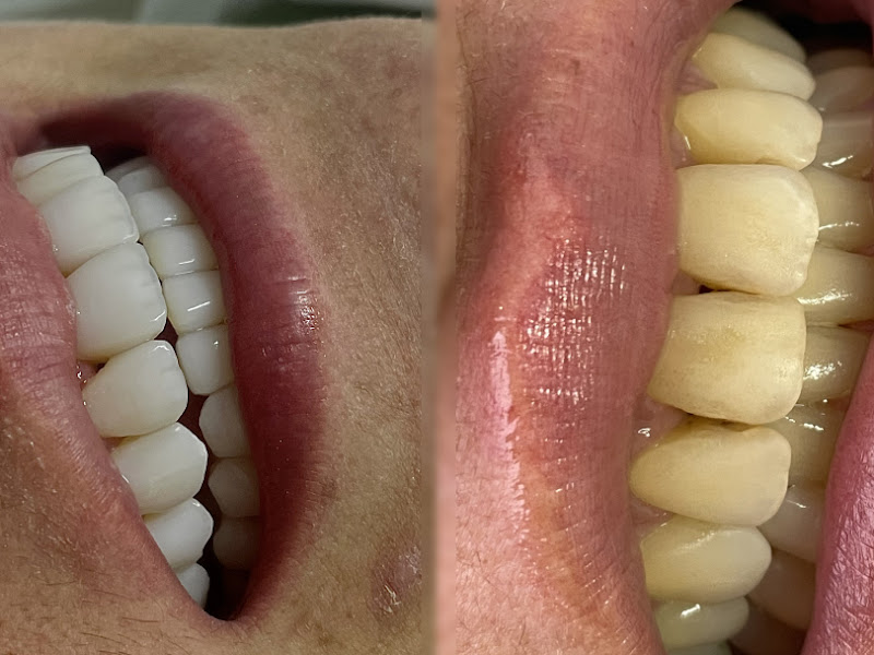 Foto 7 de Dra. Nayara Oliveira | Dentista Mogi das Cruzes | Clareamento Dental