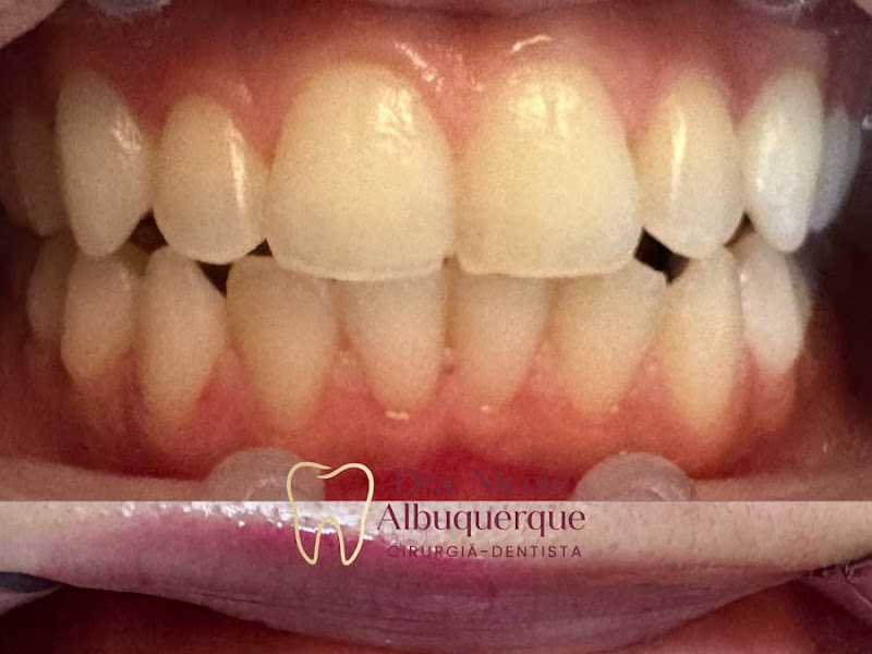 Foto de Dra. Nicole Albuquerque | Cirurgiã Dentista