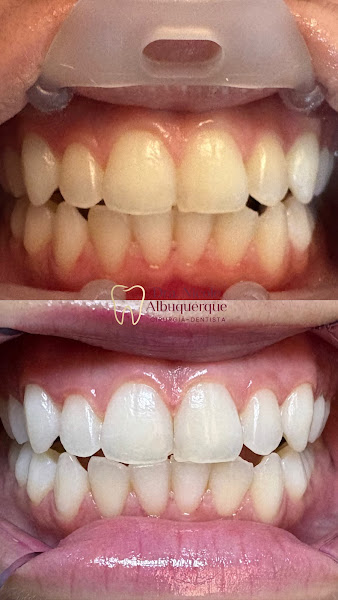 Foto 2 de Dra. Nicole Albuquerque | Cirurgiã Dentista