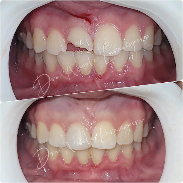 Foto 2 de Dra . Nicole Larangeira Odontologia