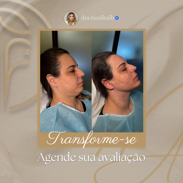 Foto 3 de Dra. Nicolle Albuquerque - Cirurgia & Harmonização Orofacial Estética