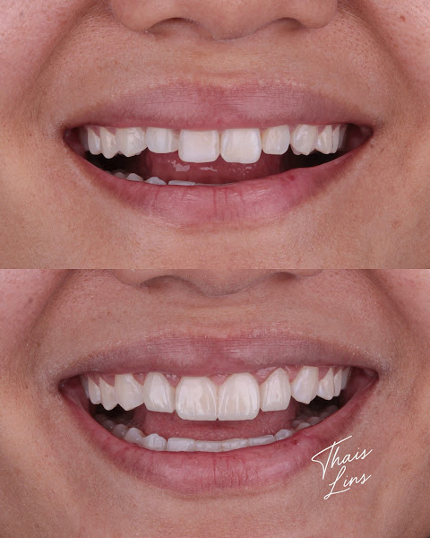 Foto 2 de Dra. Nikole Andrade - ProFace Clinic