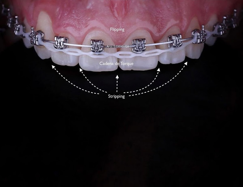 Foto 3 de Dra. Nikole Andrade - ProFace Clinic