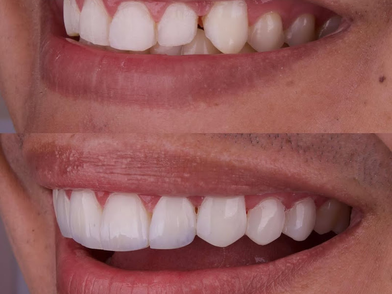 Foto 3 de Dra.Nirmalla Persaud - Dentista