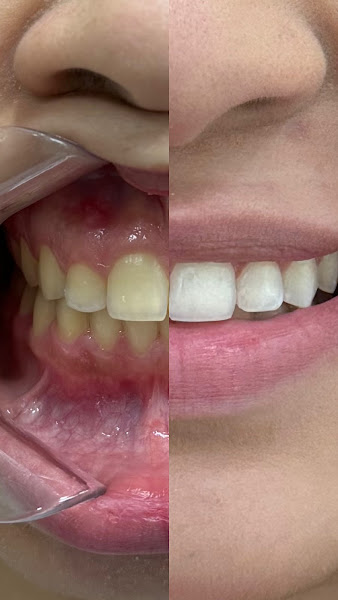 Foto 3 de Dra. Noemi Dantas| Ortodontia| Implantodontia| Harmonização Facial