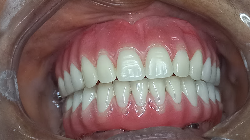 Foto 2 de Dra. Onizia Torres Cirugiã Dentista