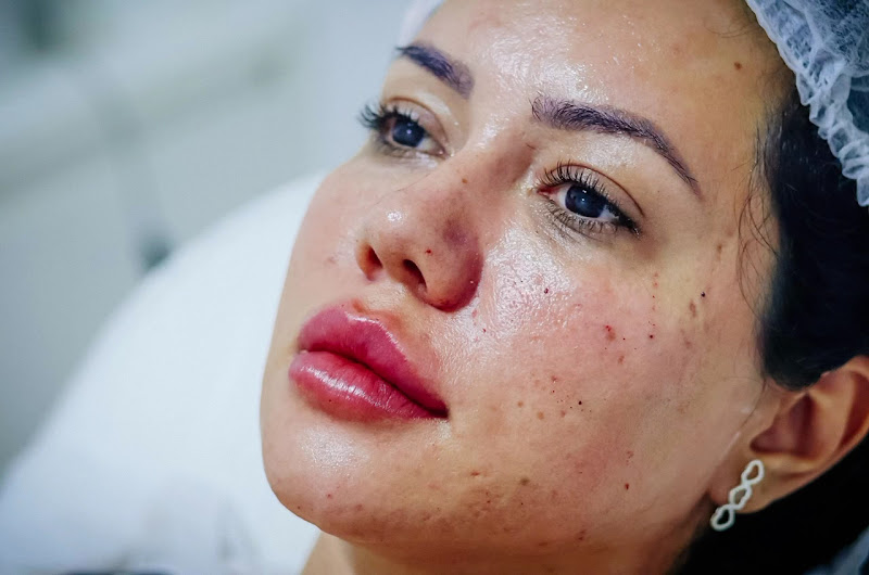 Foto 3 de Dra. Pabline Martins Estética Avançada & Cia | Harmonização Facial | Botox | Cidade Nova, Belo Horizonte