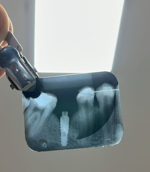 Foto 2 de Dra Paloma Anjos - DENTISTA