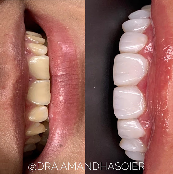 Foto 3 de Dra. Paloma Soier e Dra. Amandha Soier Odontologia Integrada