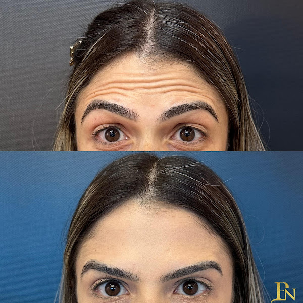 Foto 3 de Dra.Pâmela Nicodemos - Harmonização Facial