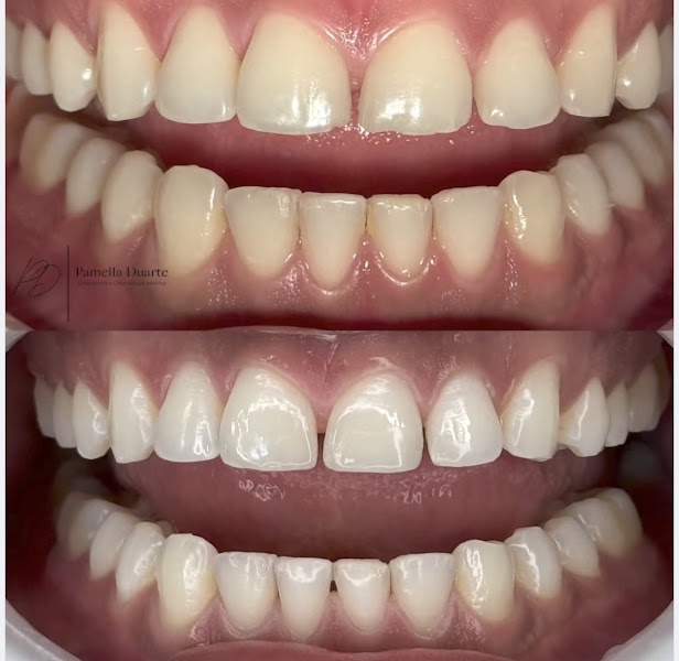 Foto 3 de Dra. Pamella Duarte | Dentista em Porto Velho