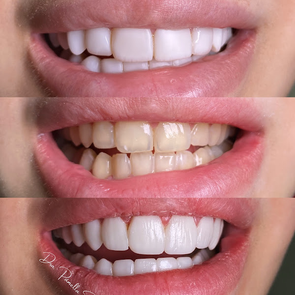 Foto 2 de Dra Pâmella Freitas | Dentista Em SP | Lentes em Resina & Harmonização Facial