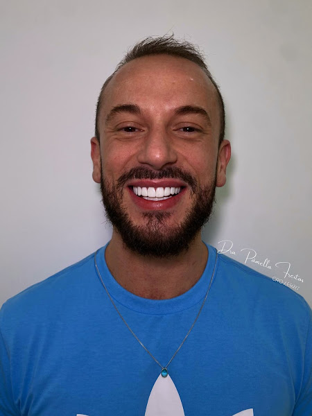 Foto 3 de Dra Pâmella Freitas | Dentista Em SP | Lentes em Resina & Harmonização Facial