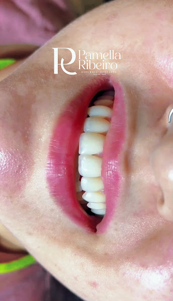 Foto 3 de Dra. Pamella Ribeiro Odontologia Estética e Reabilitadora