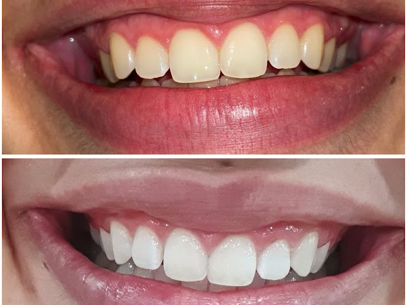 Foto 2 de Dra. Paola Cristina da Mata - Cirurgiã Dentista