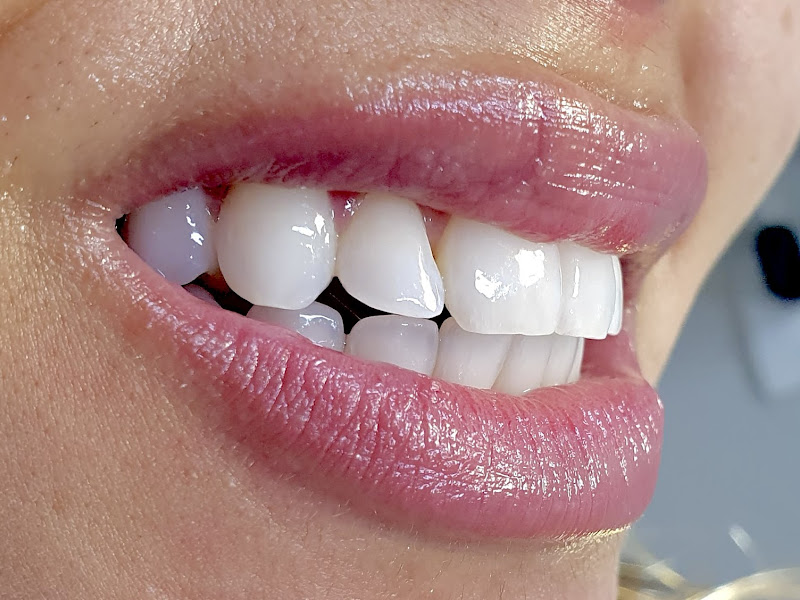 Foto 3 de Dra. Paola Cristina da Mata - Cirurgiã Dentista