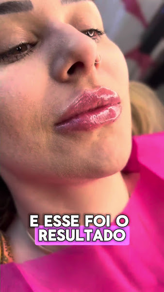 Foto 3 de Dra. Patricia Alves - Instituto da Face