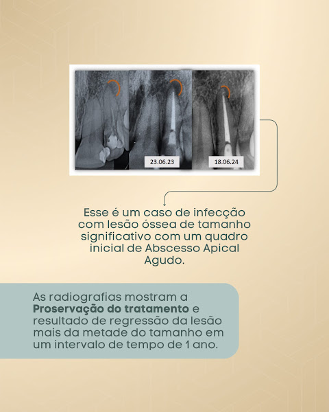 Foto 3 de Dra. Patrícia Oliveira | Endodontia | Microscópica Digital - Imperatriz MA